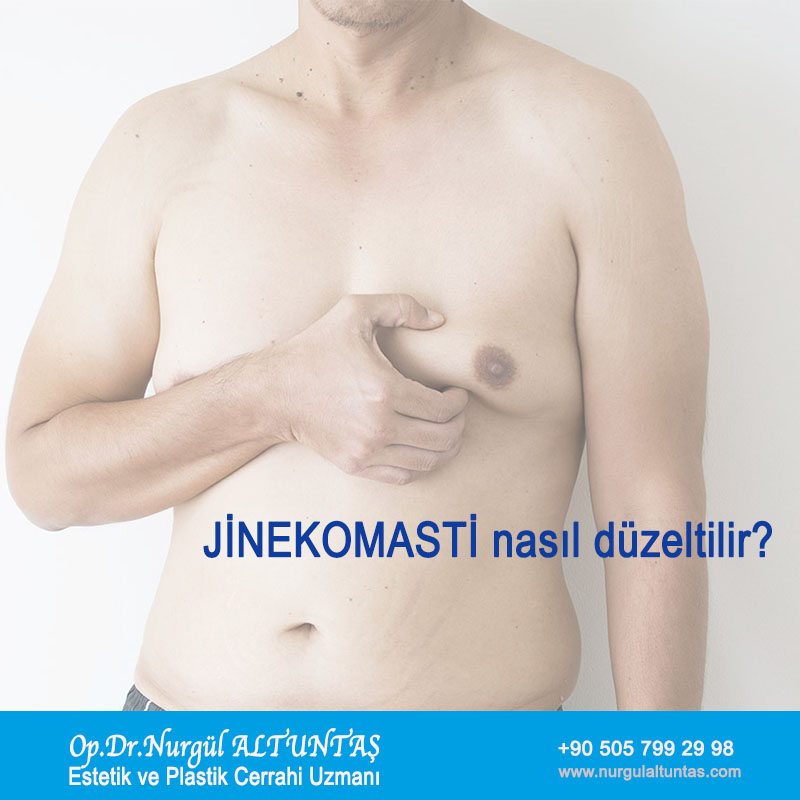 Jinekomasti Düzeltilmesi Nasıl Uygulanır?