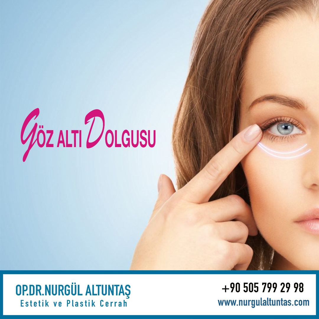 Göz altı ışık dolgusu nedir?