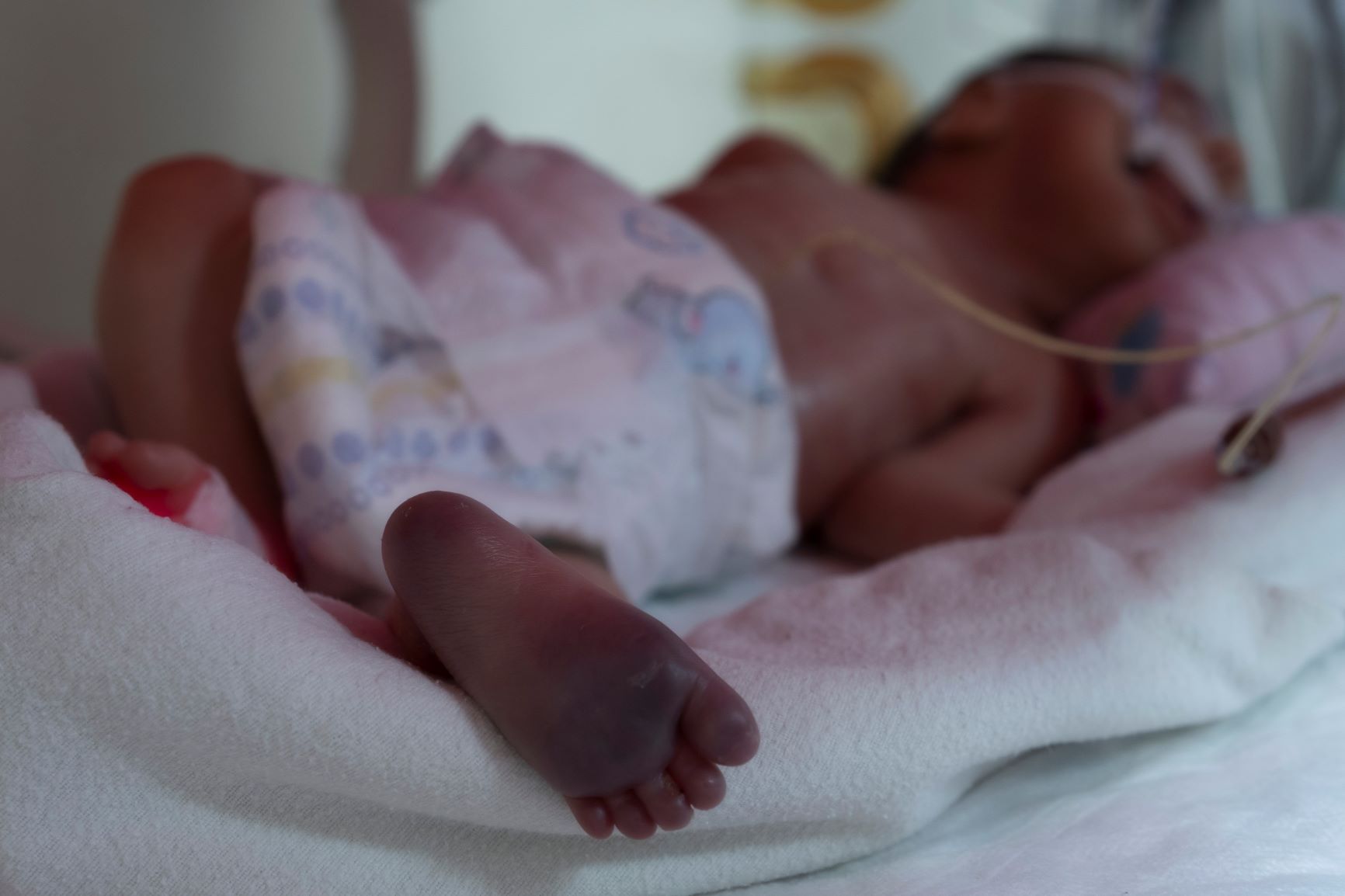 Çocuklarda Doğumsal Kalp Hastalıklarının Belirtileri