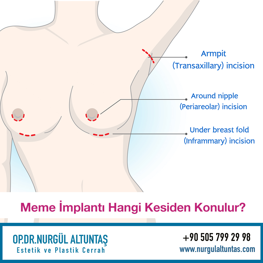 Meme Büyütmede Kesiler