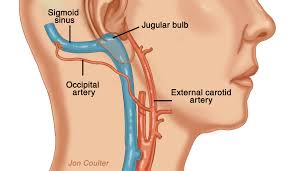 Tinnitus ve damarsal nedenler