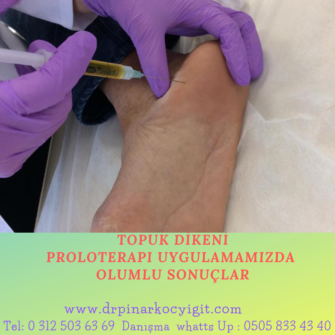 Topuk Dikeninde Yüz Güldüren Yeni Nesil Tedaviler