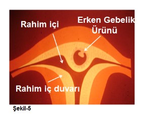 İşte Mucize