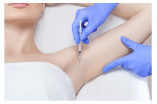 Hiperhidrozis (Aşırı Terleme)