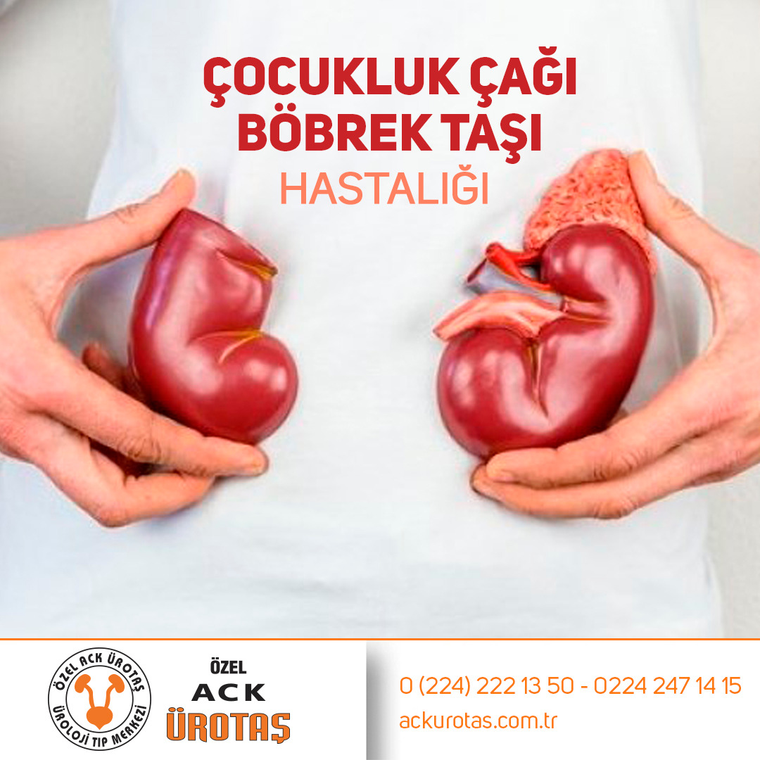 Çocukluk çağı böbrek taşı hastalığı