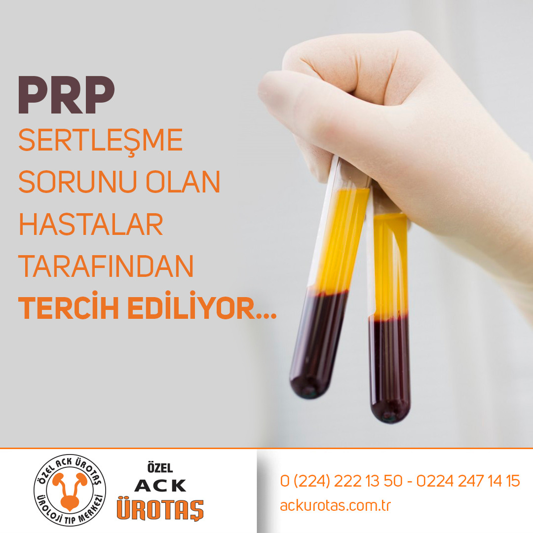 PRP,SERTLEŞME SORUNUNDA TERCİH EDİLİYOR. makalesi