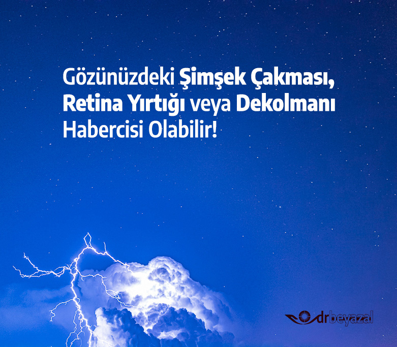 Retina dekolmanı tedavisi