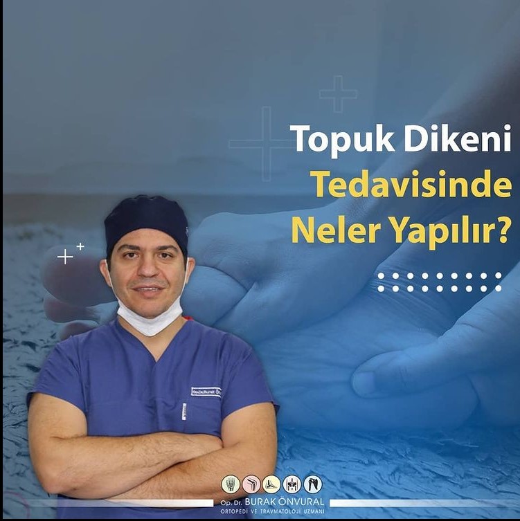 Topuk Dikeni Tedavisinde Neler Yapılır? makalesi