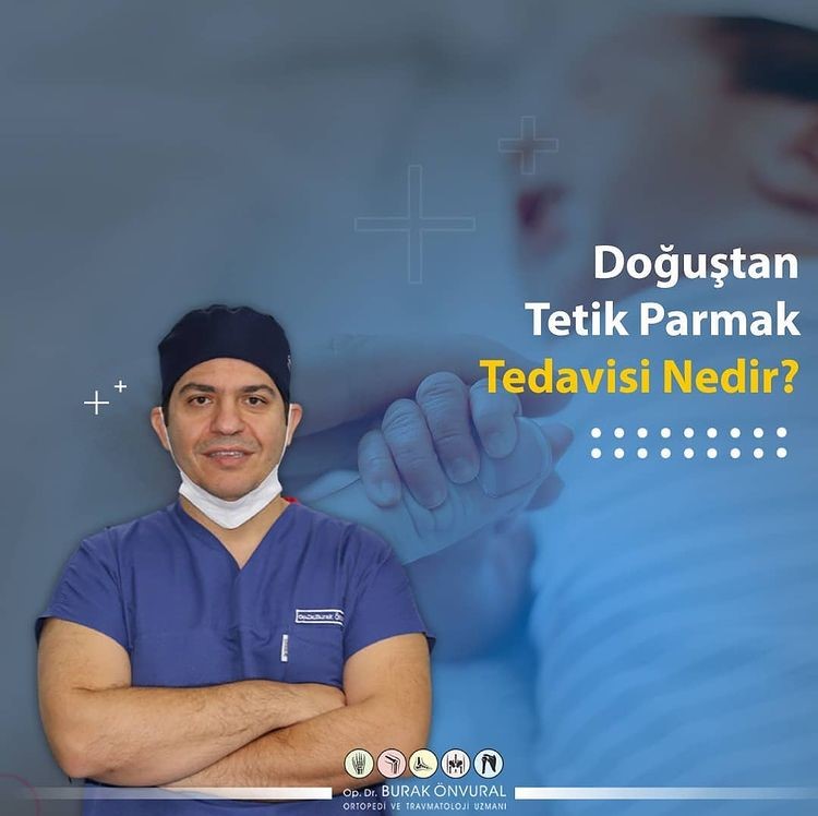 Doğuştan Tetik Parmak Tedavisi Nedir? makalesi