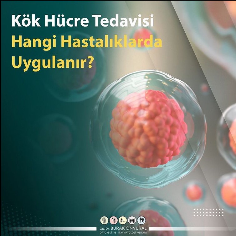 Kök Hücre Tedavisi Hangi Hastalıklarda Uygulanır? makalesi