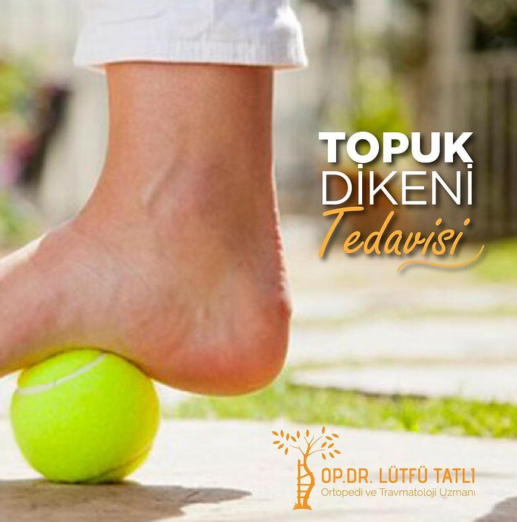 Topuk Dikeni Nasıl Tedavi Edilir?