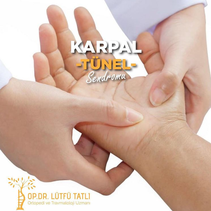 Karpal Tünel Sendromu Nedir? Tedavisi Nasıl Yapılır?