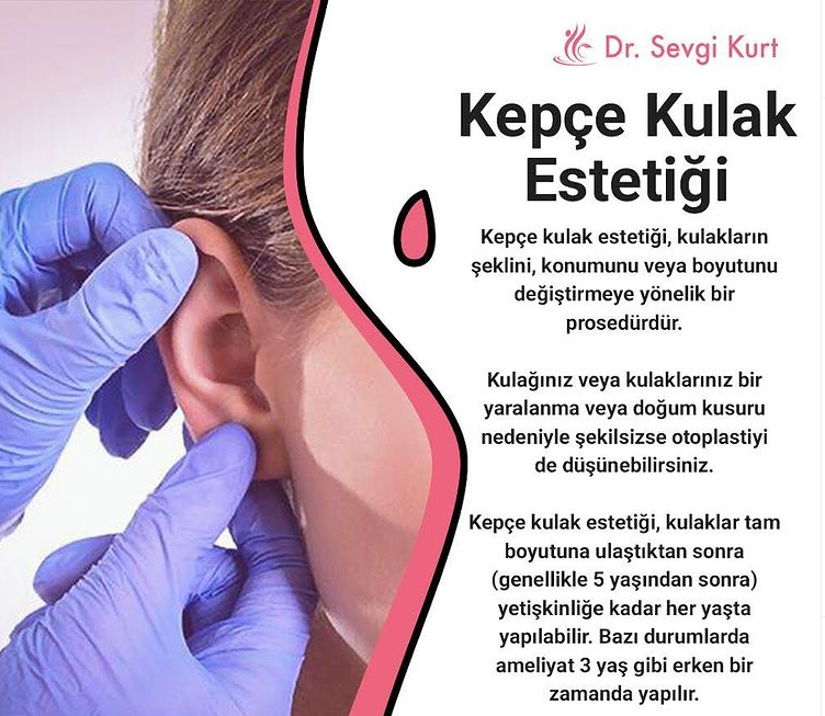 Kepçe Kulak Estetiği (Otoplasty)