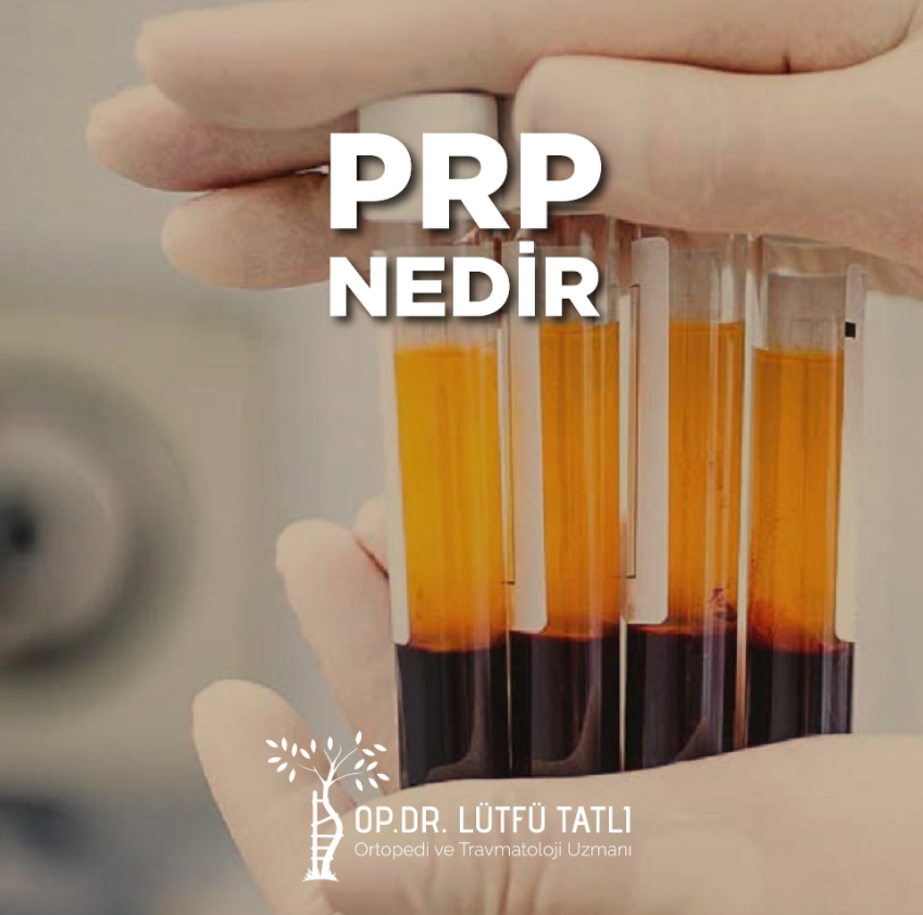 PRP (Platelet Rich Plasma) tedavisi Nedir