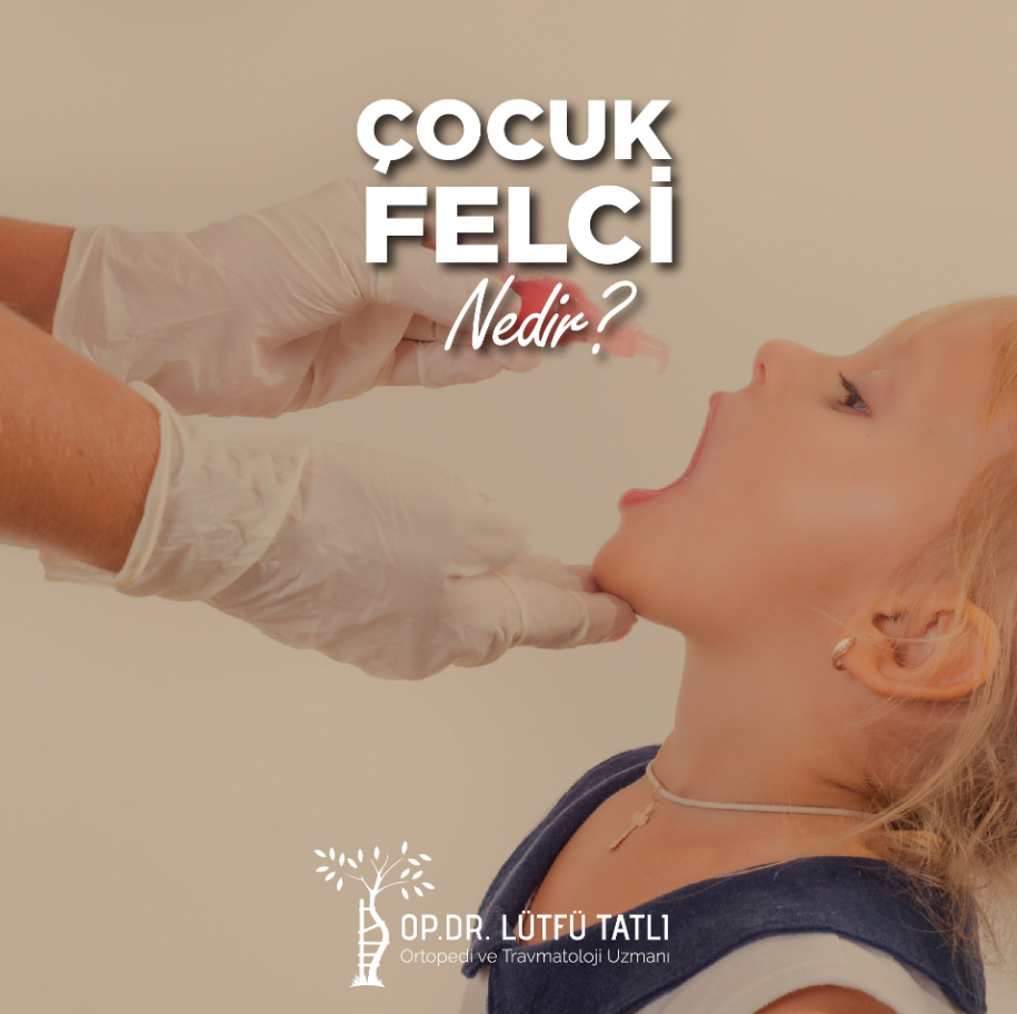 Çocuk Felci Nedir?