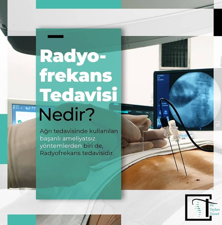 Radyofrekans Tedavisi Nedir?
