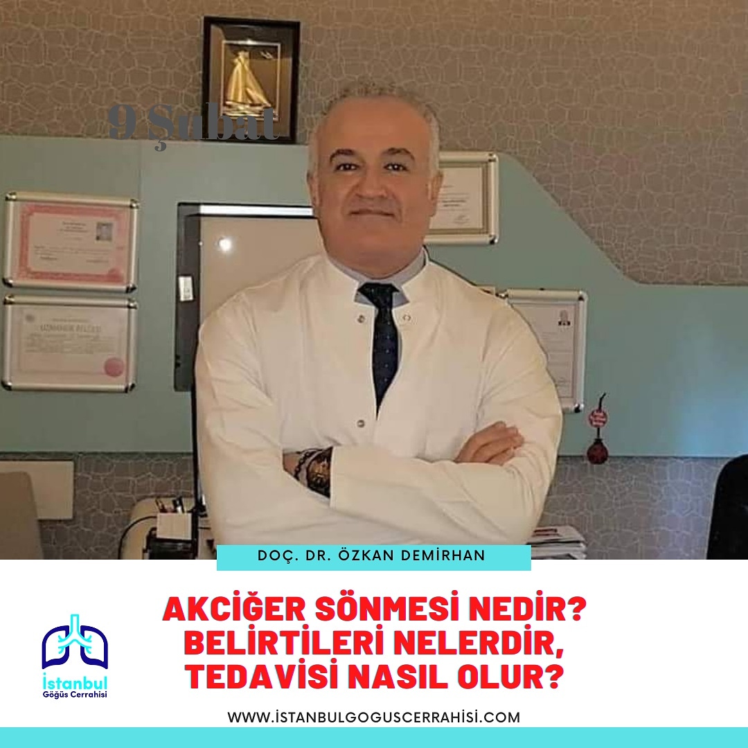 Akciğer Sönmesi Nedir? Belirtileri Nelerdir? Tedavisi Nasıl Olur?