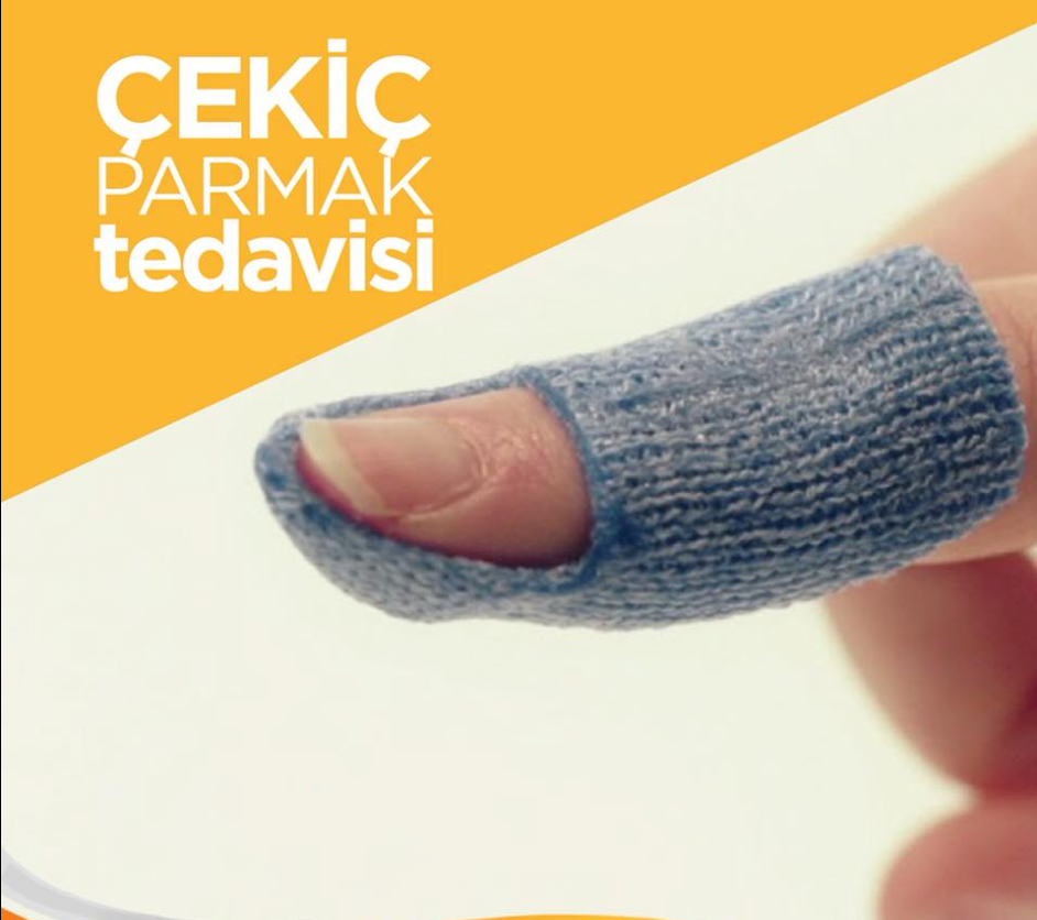 ÇEKİÇ PARMAK TEDAVİSİ