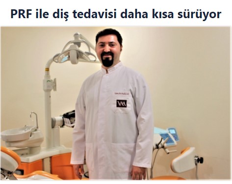 PRF ile diş tedavisi daha kısa sürüyor makalesi