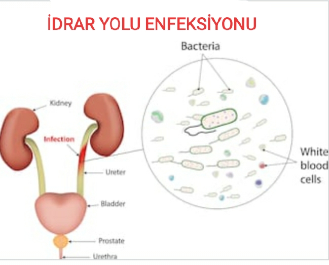 ÜRİNER SİSTEM ENFEKSİYONLARI