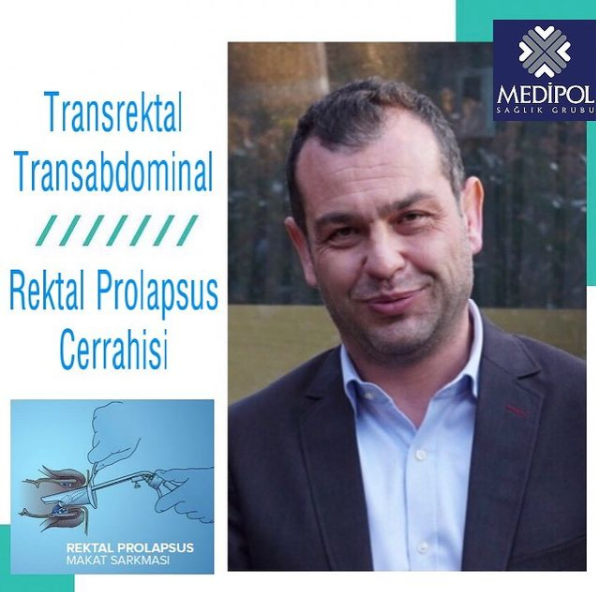Rektal Prolapsus Cerrahisi