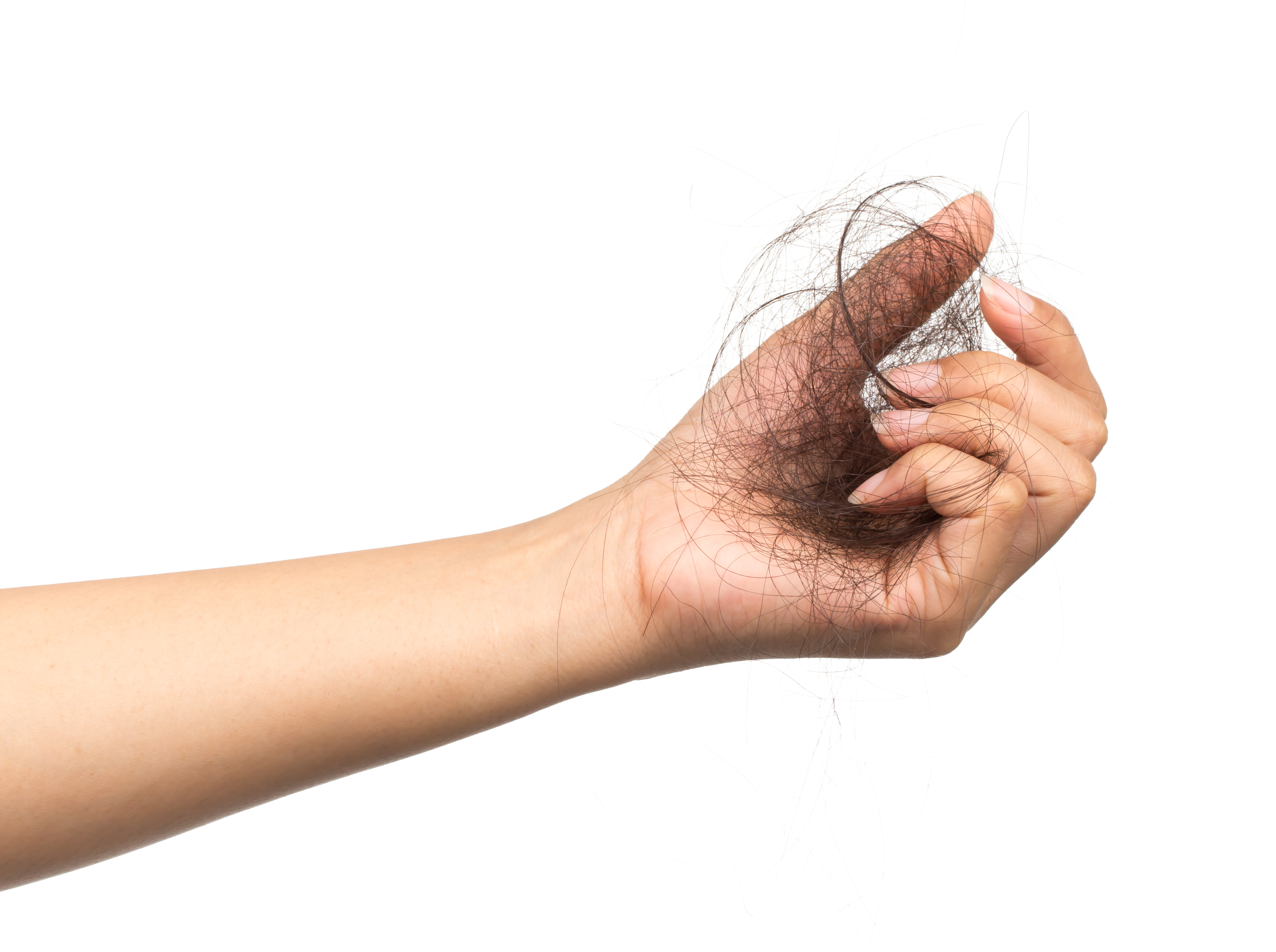 Saç Dökülmesi (Alopesi)