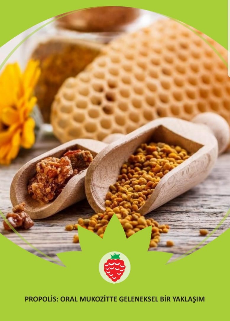 PROPOLİSİN ORAL MUKOZİT ÜZERİNE ETKİSİ