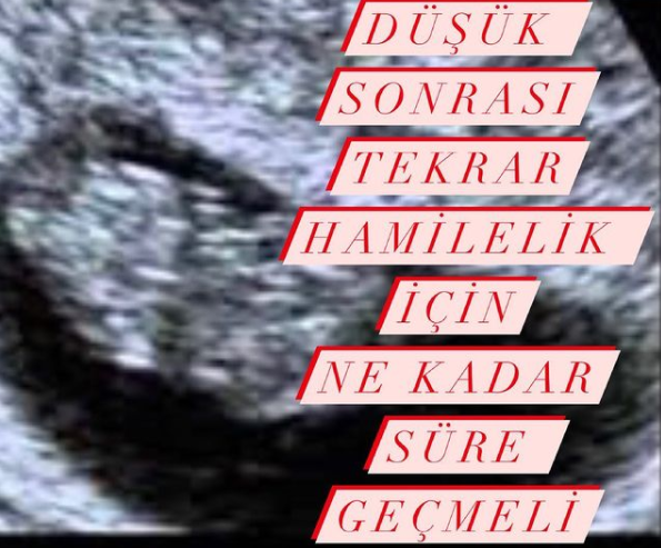 Düşük Sonrası Hamilelik İçin Ne Kadar Süre Geçmeli?