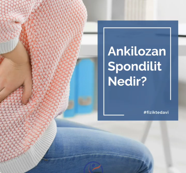 Ankilozan Spondilit Nedir?