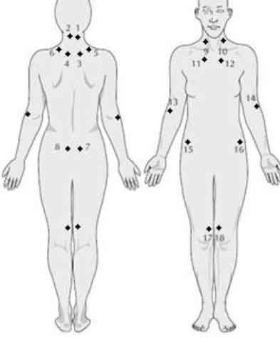 Fibromiyalji: Nedir? Tedavi de Kullanılan Yöntemler Nelerdir?