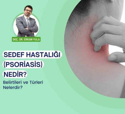 Sedef Hastalığı (Psoriasis) Nedir?