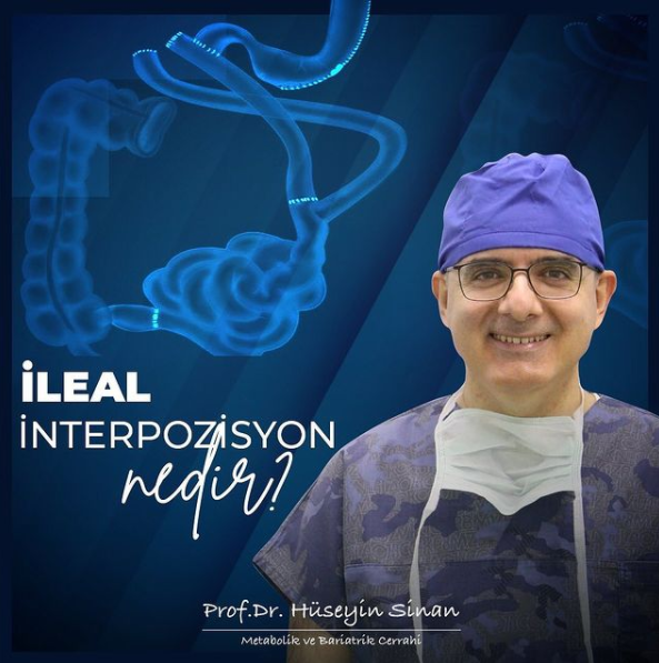 İleal İnterpozisyon nedir?