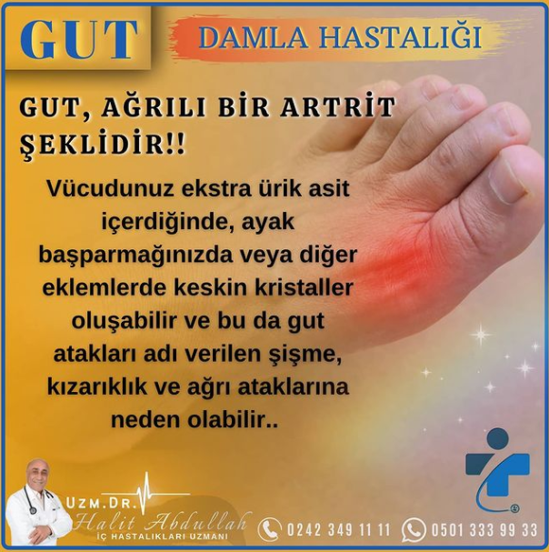 Gut (Damla Hastalığı) makalesi