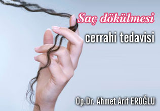 Saç dökülmesi ve cerrahi olarak tedavisi1