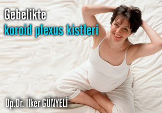 Gebelikte koroid plexus kistleri