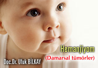 Hemanjiyom (damarsal tümörler)