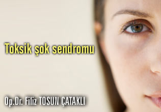 Toksik şok sendromu