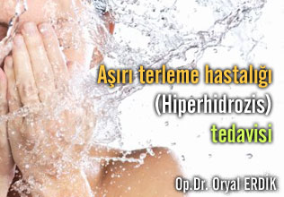 Aşırı terleme hastalığı (hiperhidrozis) tedavisi makalesi