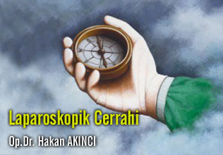 Laparoskopik cerrahi!