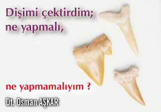 Dişimi çektirdim;ne yapmalı,ne yapmamalıyım?