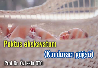 Pektus ekskavatum (kunduracı göğsü) makalesi