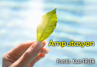 Amputasyon makalesi