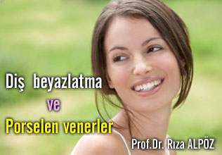 Diş beyazlatma ve porselen venerler makalesi