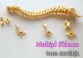 Multipl skleroz (ms)