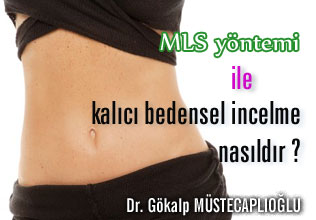 Mls yöntemi ile kalıcı bedensel incelme nasıldır ?