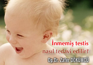 İnmemiş testis nasıl tedavi edilir ? makalesi