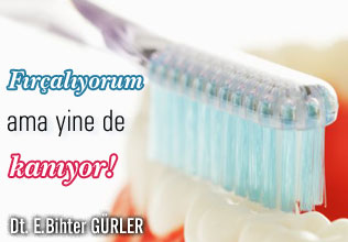 Fırçalıyorum ama yine de kanıyor !