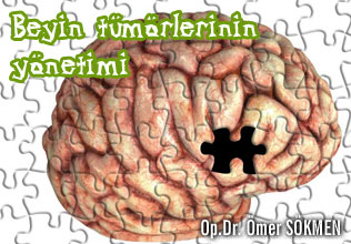 Beyin tümörlerinin yönetimi