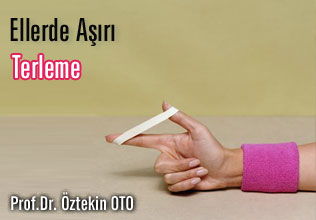 Ellerde aşırı terleme (hiperhidrozis) makalesi