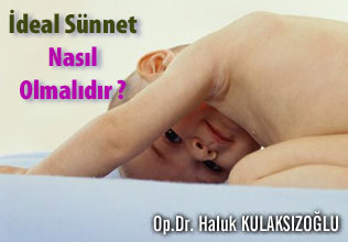 İdeal sünnet nasıl olmalıdır ?